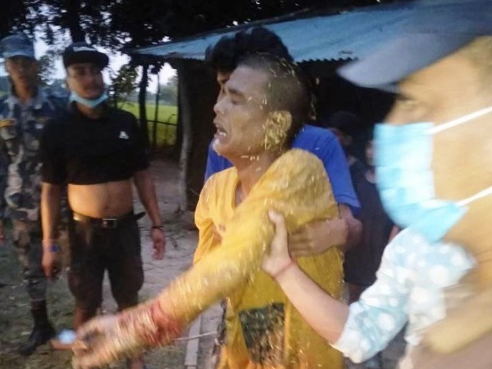 धारिलो हतियार प्रहारबाट घाइते भएका तीनजना नेपालगञ्ज रेफर