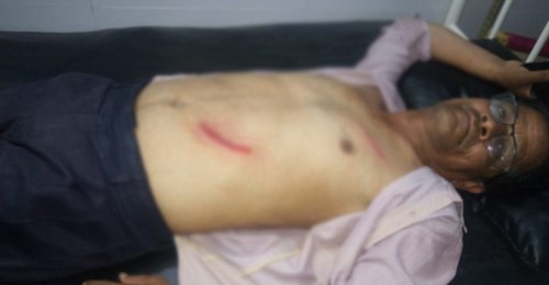 अज्ञात समुहद्वारा बेदकोटका वडाध्यक्ष माथि धारिलो हतियार प्रहार