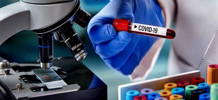 कञ्चनपुरमा कोरोना सङ्क्रमित बढ्दै