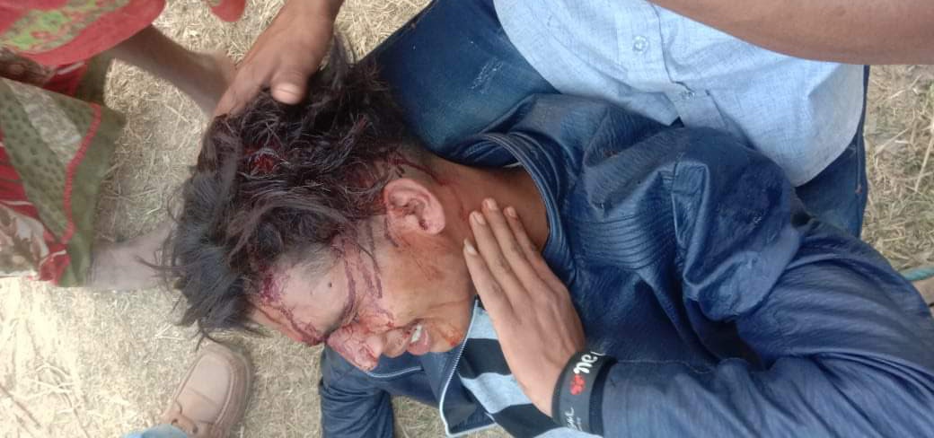 डोटीमा चक्कु प्रहारबाट एक युवक घाइते