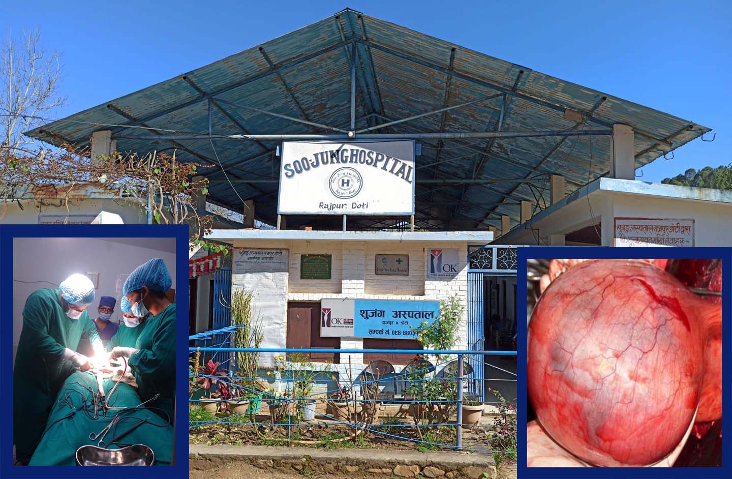 जब, भारत पुग्नुपर्ने समस्याको दिपायलमै उपचार भयो…