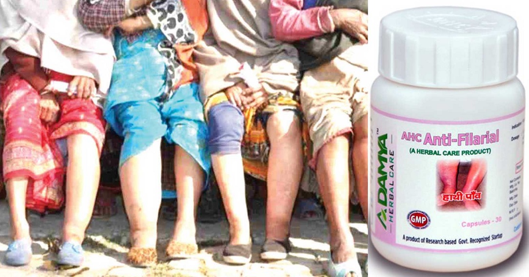 कैलालीमा ५ लाखले खाए हात्तीपाइलेविरुद्धको औषधि, छैन औषधि खाए / नखाएको सुपरिवेक्ष